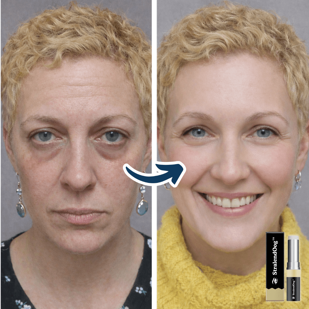 StralendOog™ Oogbalsem